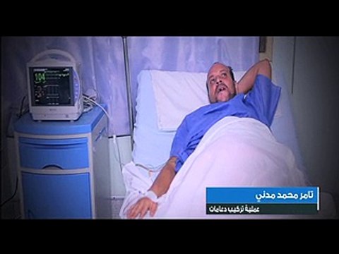 استجابة لتوجيهات السيسي.. إجراء عملية قلب مفتوح عاجلة لمريض بمستشفى المنصورة