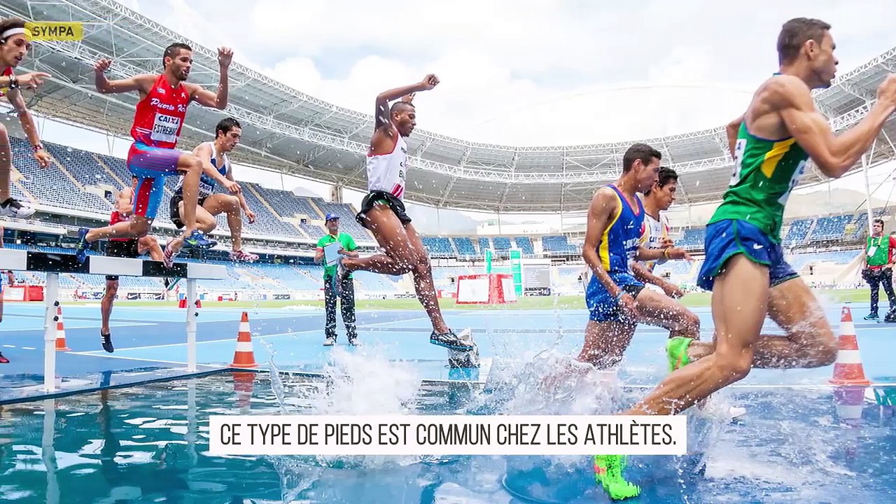 Ce Que Révèle la Forme de Tes Pieds