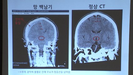故 백남기 물대포로 사망...손해배상 취하 권고 / YTN