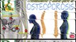 Osteoporosis, Cómo fortalecer los huesos, Tratamiento y dieta para la osteoporosis
