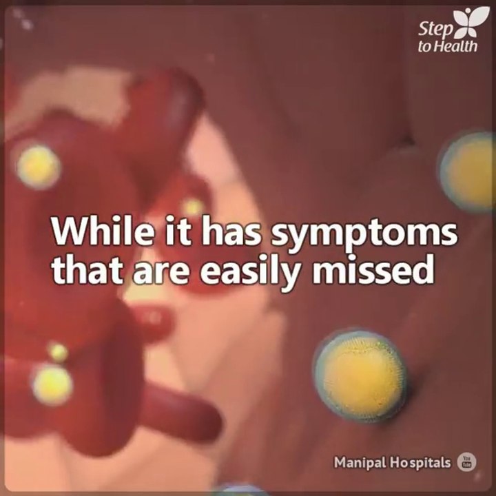 You may have sky-high triglycerides and not even know it: here are the symptoms associated with the condition