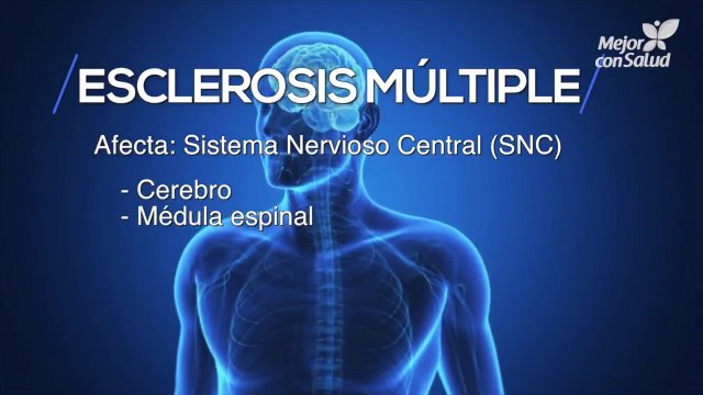 ¿Qué es la esclerosis múltiple?