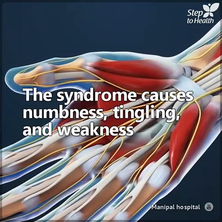 3 simple strategies for relief from Carpal Tunnel Syndrome