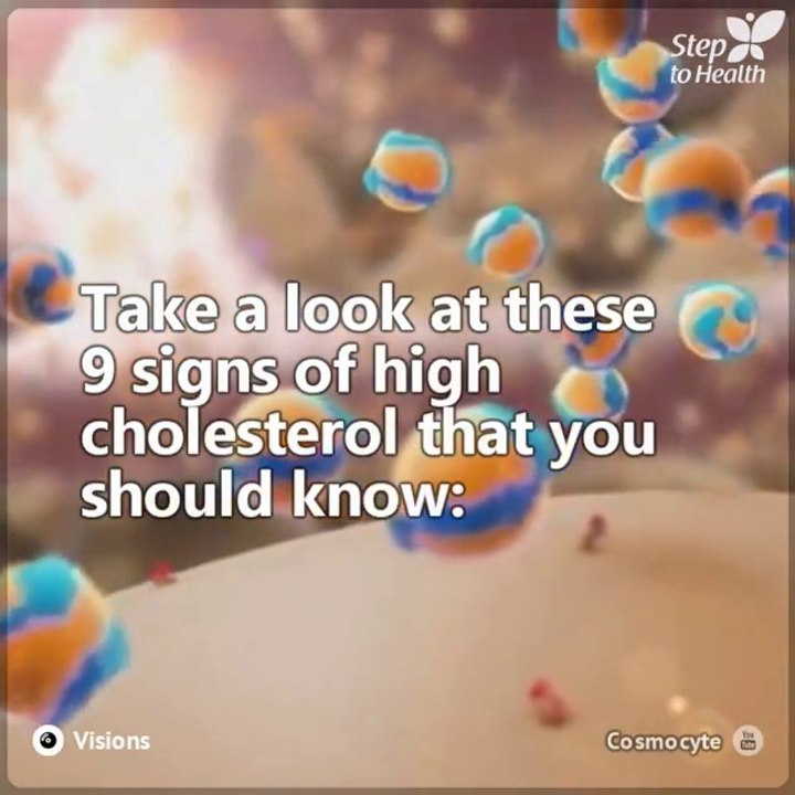 You may have high cholesterol for years and not know it until it gives its first, and final warning. Your health is important: learn how to spot the most common symptoms