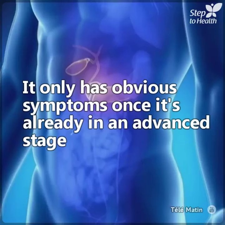 Pancreatic cancer is now one of the most dangerous types of cancer. While it doesn't usually have obvious symptoms, you can be on the lookout for subtle hints. Remember that early detection saves lives.