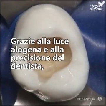 Anche se andare dal dentista può farci paura, i bravi professionisti possono realizzare vere opere d'arte della odontoiatria, come quella che stai per vedere. Una meraviglia!