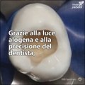 Anche se andare dal dentista può farci paura, i bravi professionisti possono realizzare vere opere d'arte della odontoiatria, come quella che stai per vedere. Una meraviglia!