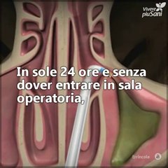 La sinuplastica con Balloon è un intervento semplice e veloce per chi soffre di sinusite cronica