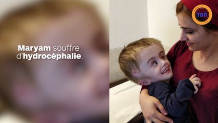 Cette petite fille a subi une opération rare pour faire réduire son énorme tête !
