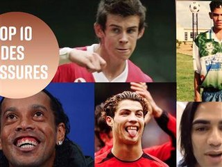 Les chirurgies les plus incroyables du football