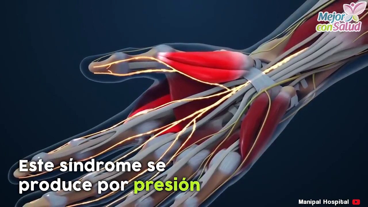 Ejercicios para aliviar el síndrome del túnel carpiano