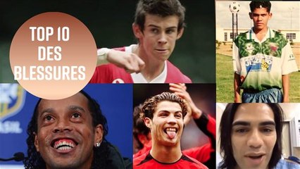 Les chirurgies les plus incroyables du football