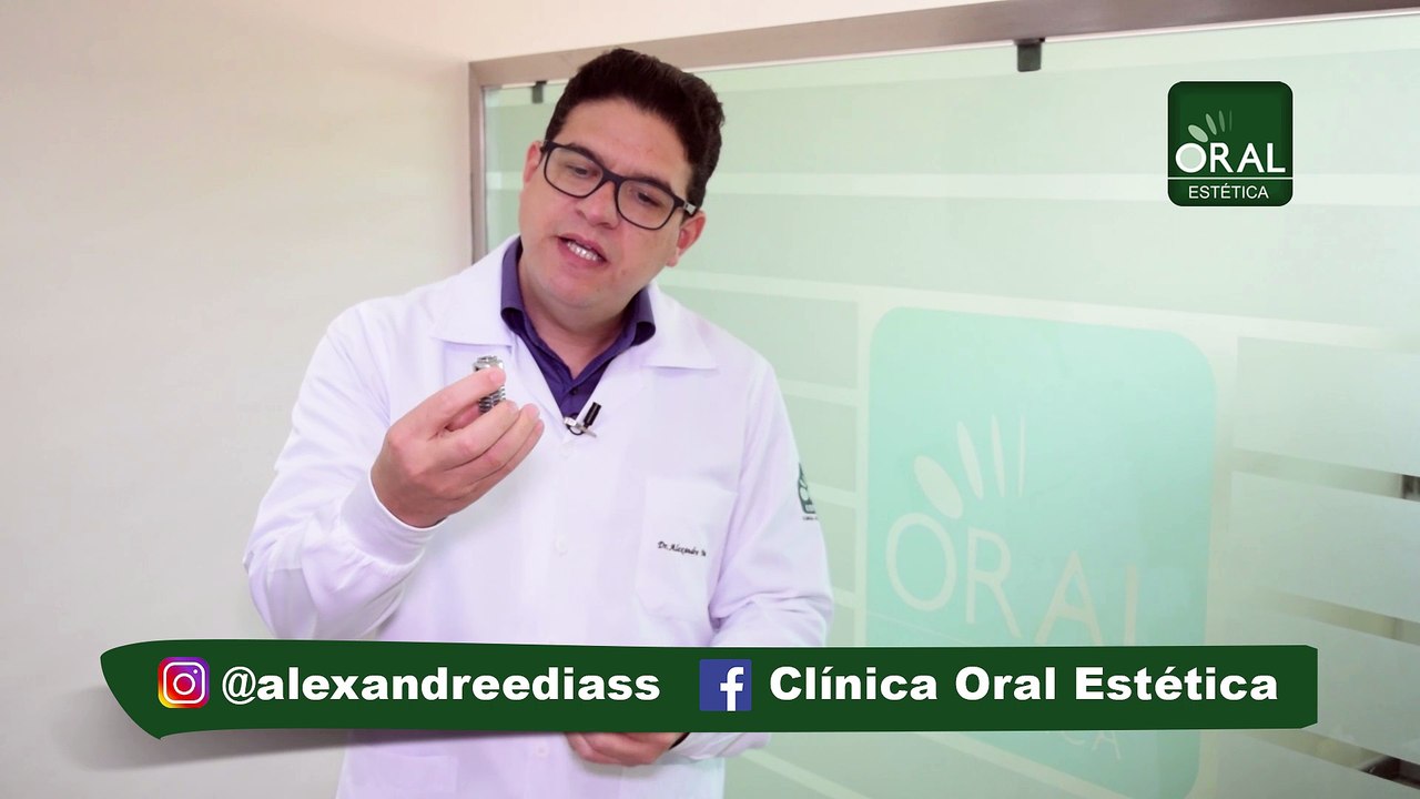 Oral Estética - Dica O que são Implantes