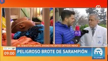 Peligroso brote de Sarampión - Mucho gusto 2018