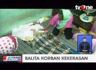 Balita Korban Penyiksaan Ayah Tiri Meninggal Dunia
