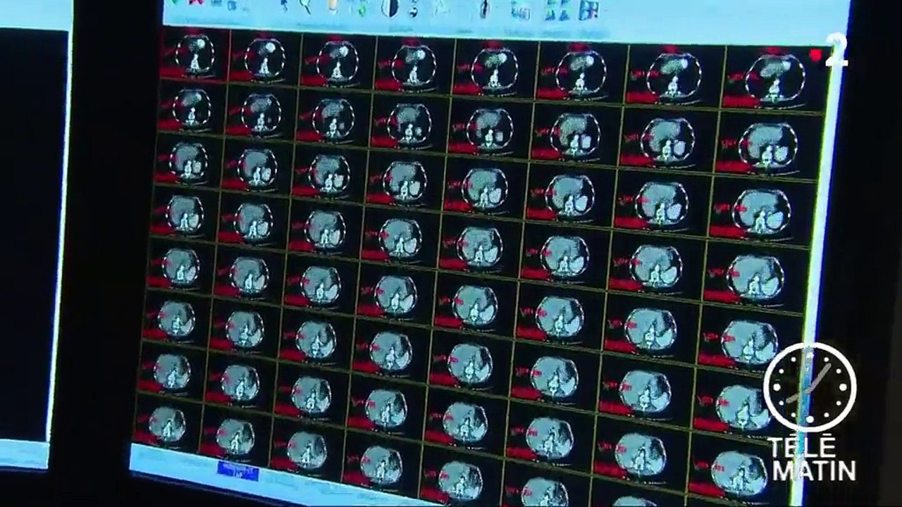 Cancer : un logiciel capable de déterminer l'efficacité des traitements en phase de test