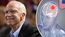 What is glioblastoma, the brain cancer that killed John McCain?