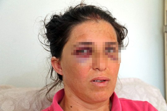 Çocuğunun Ağzında Bisküvi Artığı Kaldığı İçin Feci Şekilde Darp Edildi