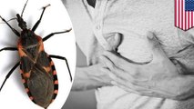 Parasitic disease spread by 'kissing bugs' on the rise in the US