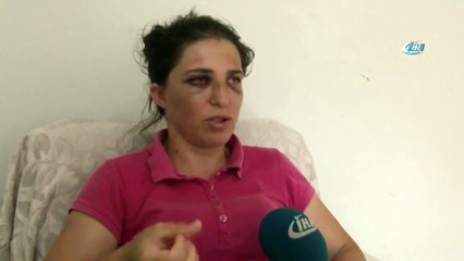 Bisküvi Kırıntılarına Sinirlendi, Eşini Tanınmaz Hale Getirdi!
