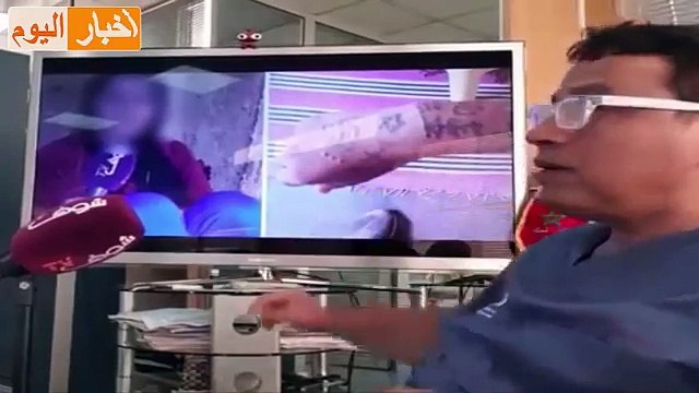 الدكتور التازي يكشف حقيقة قضية أوشام خديجة ضحية الفقيه بن صالح..... خطفوني ووشمو ليا