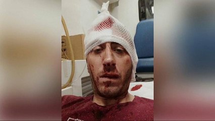 Jornalistas protestam contra agressão sofrida por repórter em Banja Luka