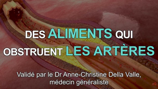 3 aliments qui peuvent obstruer les artères