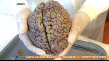 Sydney 'Brain Bank' studies athletes' head trauma