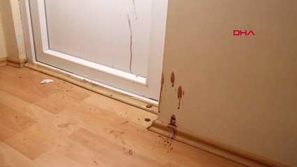 Ankara Eşini Bıçaklayıp Balkondan Atan Koca İçin Tekrar Yakalama Kararı Çıkarıldı