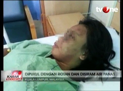 TKW Asal Lombok Disiksa Majikan di Malaysia