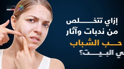 Download Video: فيديو معلوماتى.. إزاى تتخلص من ندبات وأثار حب الشباب فى البيت؟