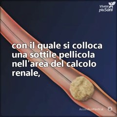 Ecco tre tecniche con cui è possibile eliminare i calcoli ai reni