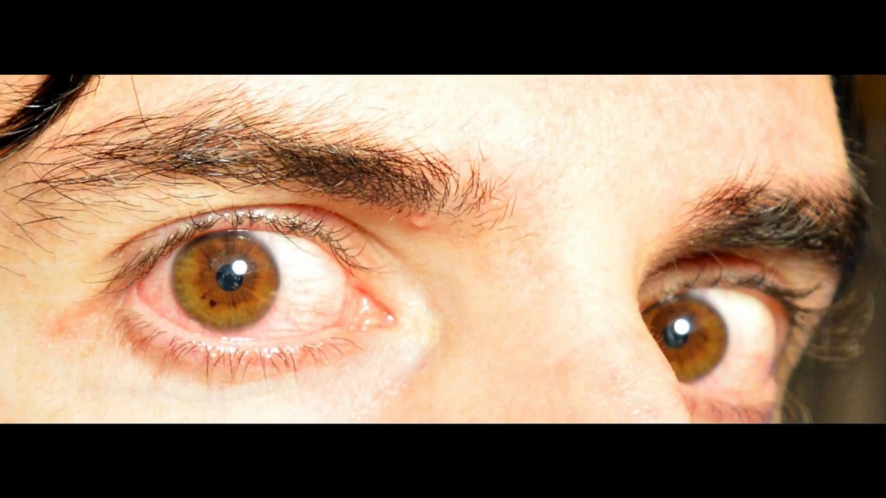 MPOV2