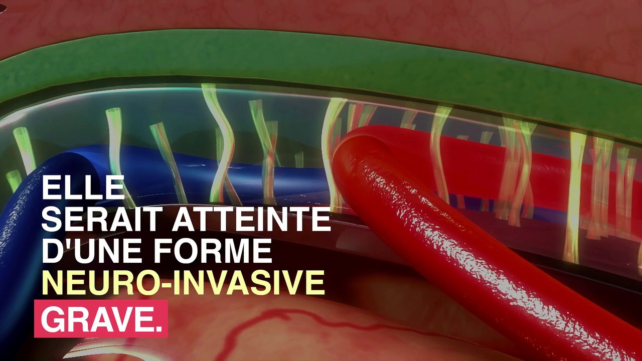 11 personnes victimes du virus West Nile dans les Alpes-Maritimes