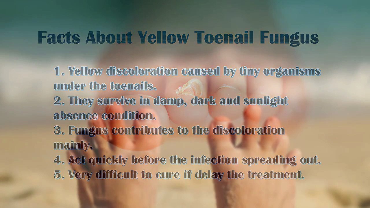 How To Get Rid Of Yellow Toenail Fungus FAST ("The Complete Guide")