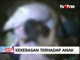 Sadis, Bocah SD Dibakar Dua Temannya Sendiri