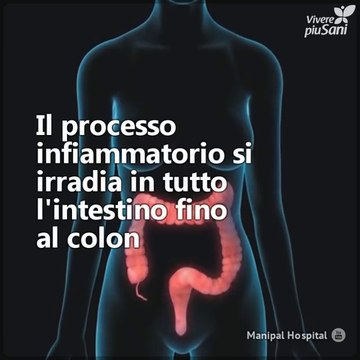 Ti spieghiamo cos'è la colite nervosa: cause, sintomi e trattamento naturale