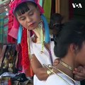 زنان کیوانی در میانمار از صد ها سال به این سو از حلقه های برنزی برای تزئین گردن شان استفاده کرده اند. استفاده از این نوع حلقه های برنزی، سمبول زیبایی در میان زن