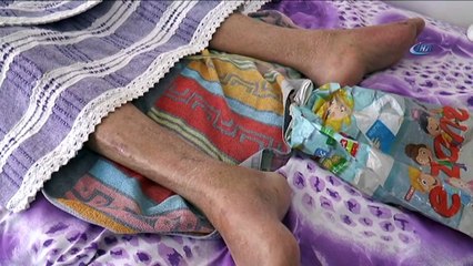 15 Temmuz’da yatalak oldu, ayağa kalkabilmek için yardım bekliyor