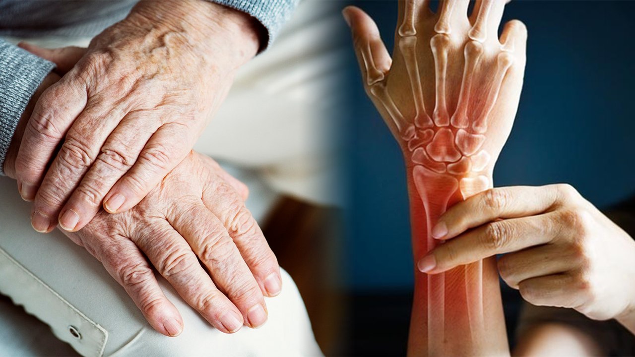 Diabetes: Increases Fracture Risk | डायबिटीज से बुजुर्गो में बढ़ जाता है फ्रैक्चर का जोखिम | Boldsky