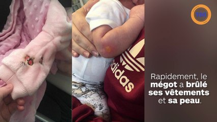 Un mégot brûle un bébé dans une poussette !