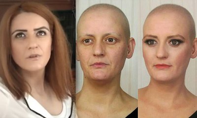 Kanserli hastayı oynadı, 9 ay sonra kanser olduğunu öğrendi