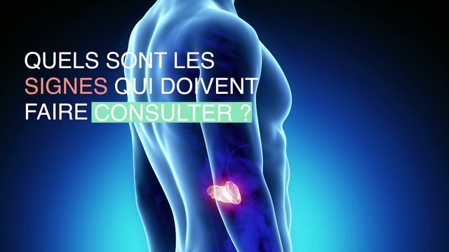 Cancer du pancréas : les 3 premiers symptômes