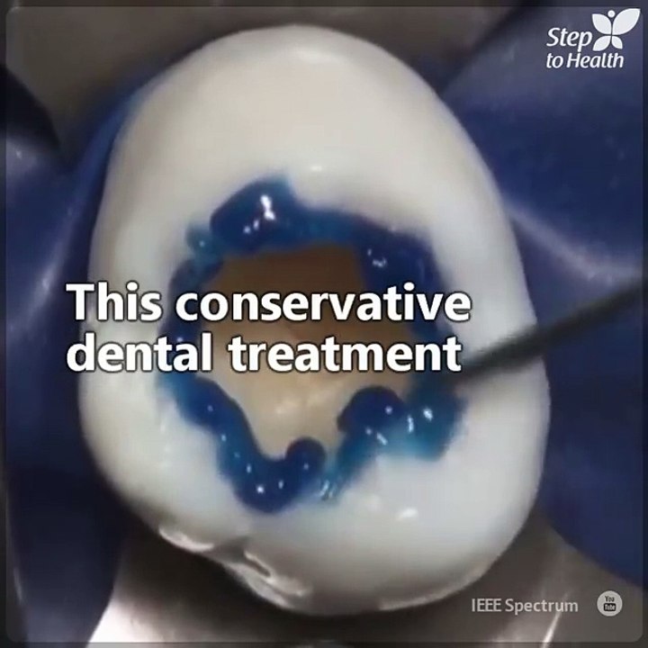 Going to the dentist may be scary sometimes, but the right professionals can do true odontological art, like you can see here. It's amazing!