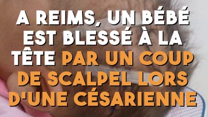 Une maman devient très inquiète après son accouchement lorsqu'elle voit son bébé !