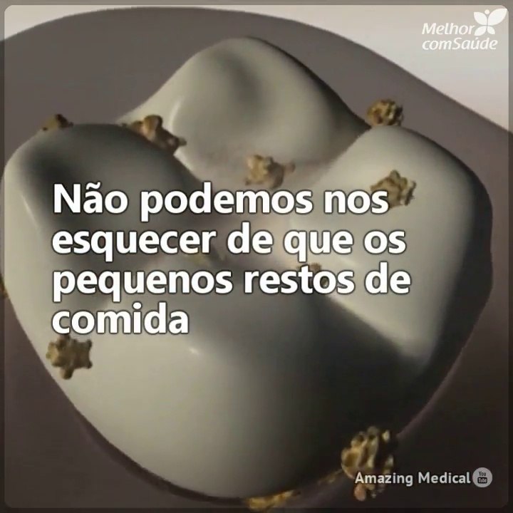 Não escovar os dentes depois de cada refeição tem sérias consequências...