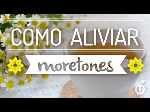 Cómo aliviar moretones | Curar moretones | Cómo reducir moretones