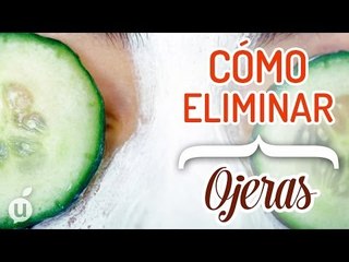 Download Video: Cómo eliminar las ojeras | Disminuir ojeras e hinchazón | Desaparecer ojeras