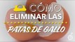 Cómo eliminar las patas de gallo | Cómo quitar las arrugas de los ojos