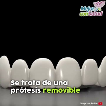 Con esta prótesis tendrás dientes perfectos en cuestión de segundos.
